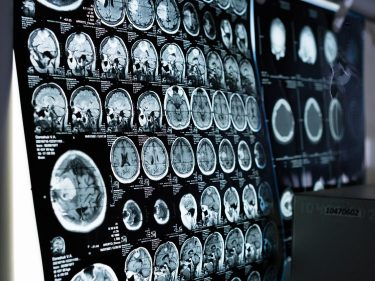 ct-scan results