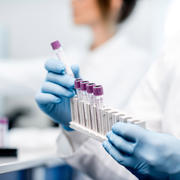 A researcher holds a row of test tubes