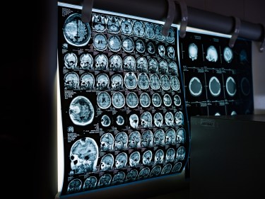 A computer monitor with x-ray photographs on it