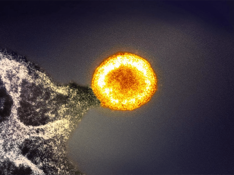 A colorized image of an HIV particle budding from an infected cell