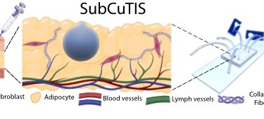 An illustration of an injection into skin